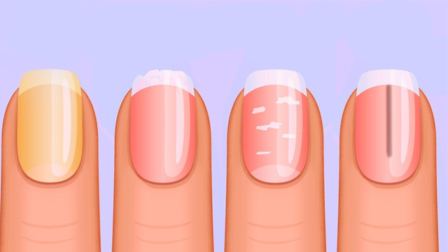 ناخن های سالمندان